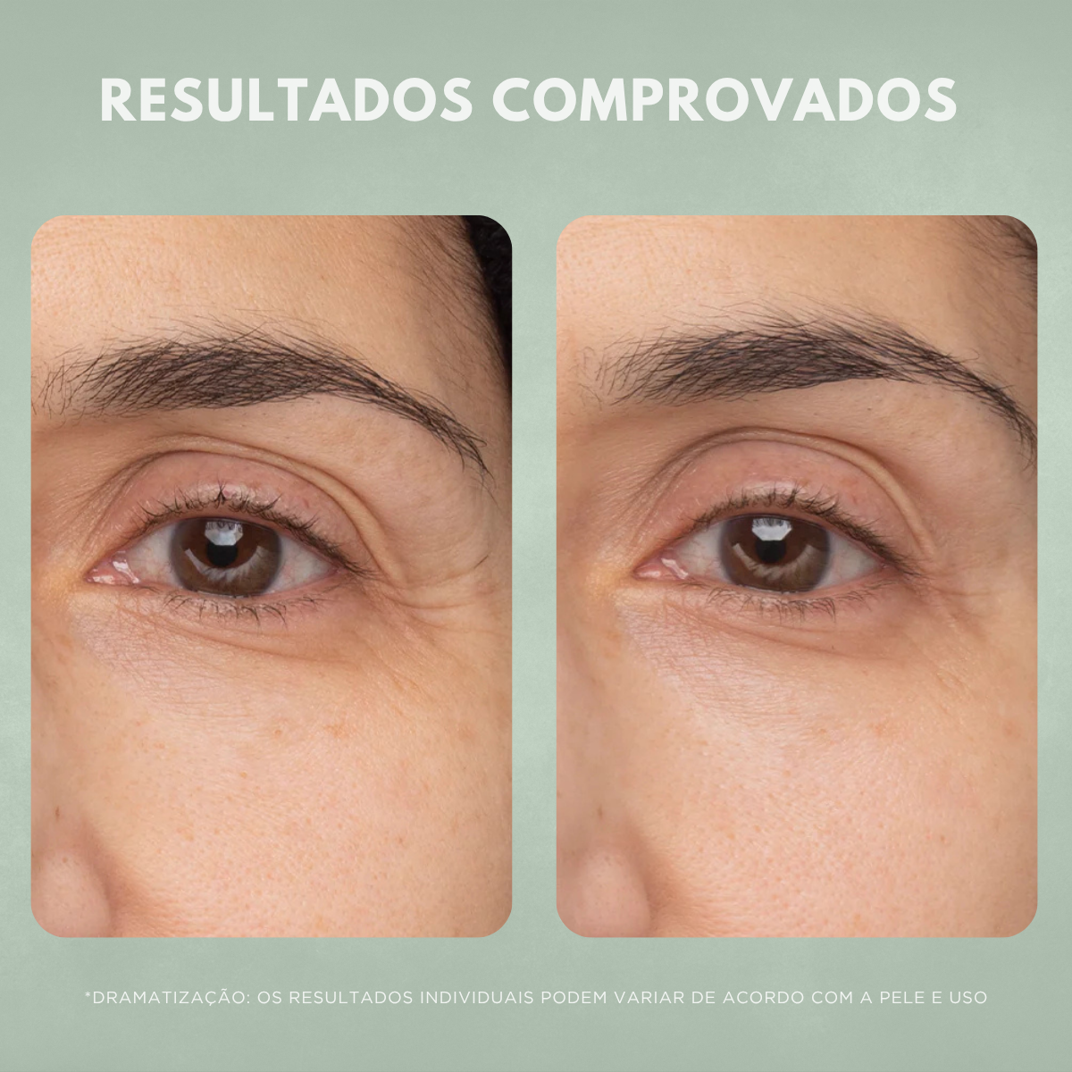 Sérum Facial Anti-idade Nuvae Retinew Com Cycloretin Rejuvenescimento e Renovação