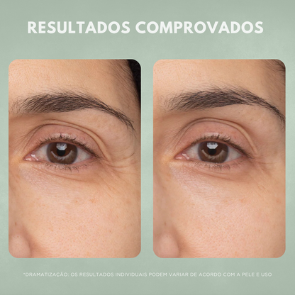 Creme Facial Antissinais Nuvae Retinew Com Cycloretin Hidratação Profunda e Rejuvenescimento