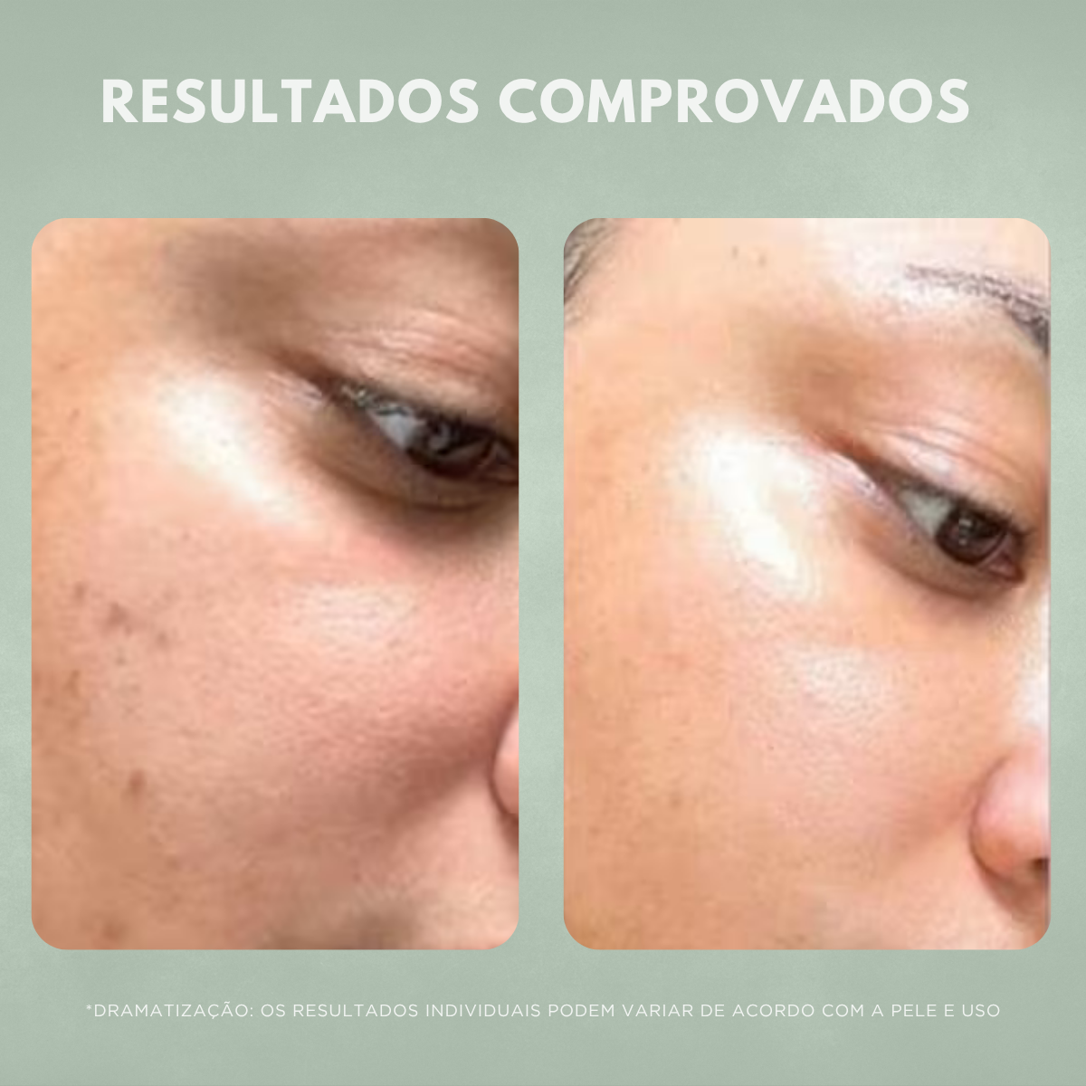Sérum Facial Anti-idade Nuvae Retinew Com Cycloretin Rejuvenescimento e Renovação