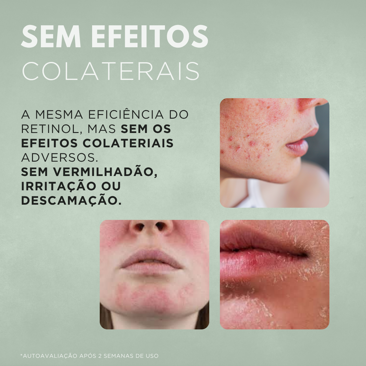 Creme Facial Antissinais Nuvae Retinew Com Cycloretin Hidratação Profunda e Rejuvenescimento